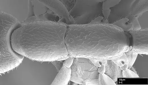 Leptanilloides gracilis specimen CASENT0234585 image casent0234585_2